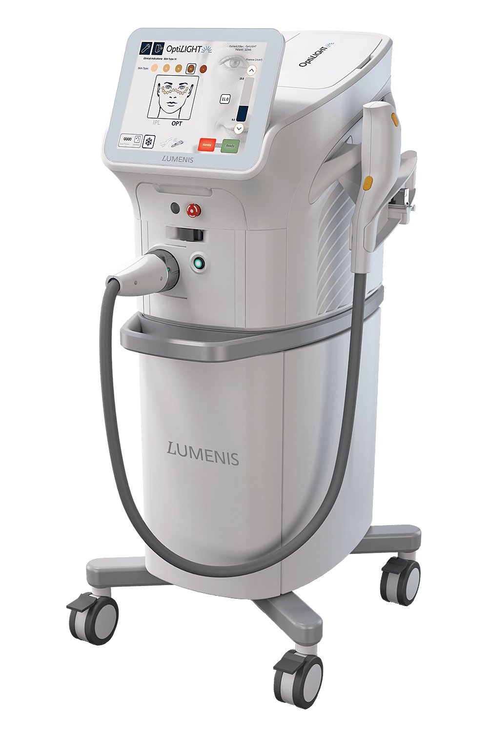 IPLレーザー治療